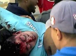 Barbarities That Go Unpunished: NATO's Libya War: A Nuremberg Level Crime