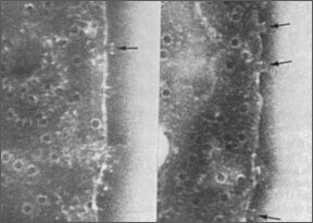Contagious Vaccines